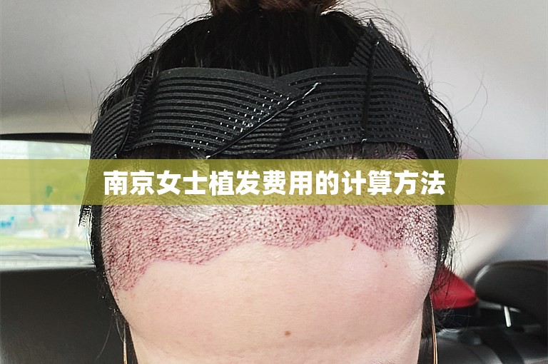 南京女士植发费用的计算方法