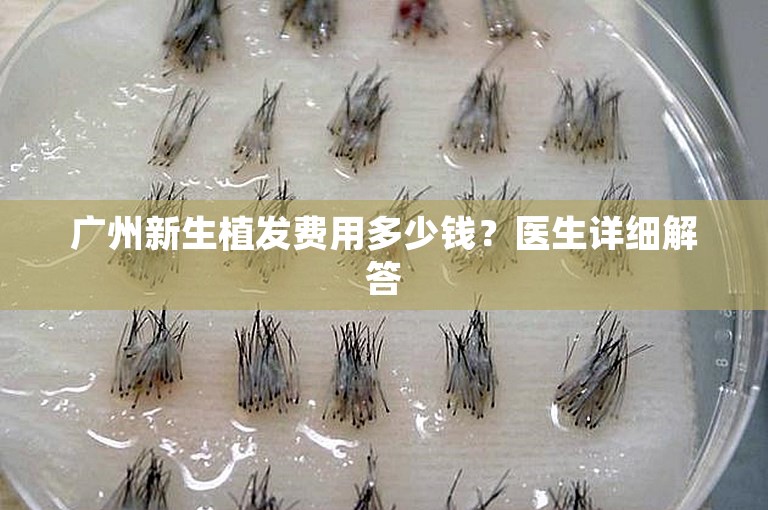 广州新生植发费用多少钱？医生详细解答