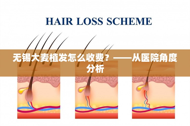 无锡大麦植发怎么收费？——从医院角度分析