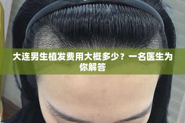 大连男生植发费用大概多少？一名医生为你解答