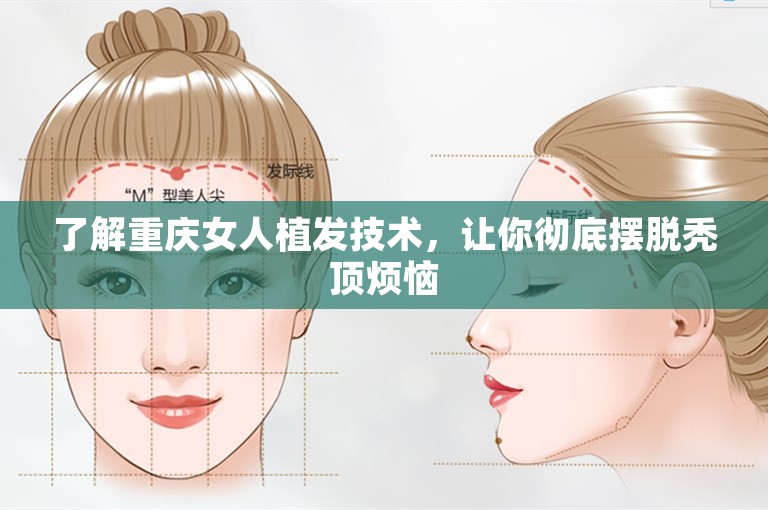 了解重庆女人植发技术，让你彻底摆脱秃顶烦恼