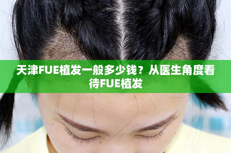 天津FUE植发一般多少钱？从医生角度看待FUE植发