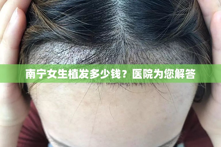 南宁女生植发多少钱？医院为您解答