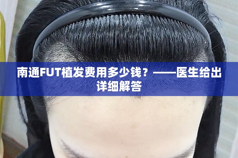 南通FUT植发费用多少钱？——医生给出详细解答