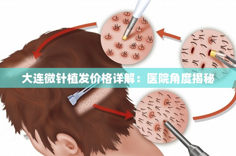 大连微针植发价格详解：医院角度揭秘