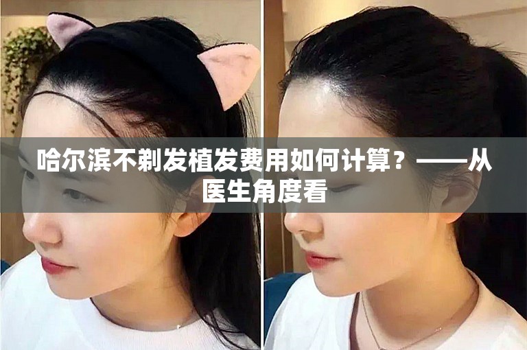 哈尔滨不剃发植发费用如何计算？——从医生角度看