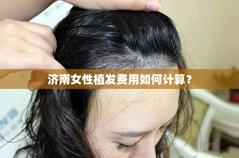 济南女性植发费用如何计算？