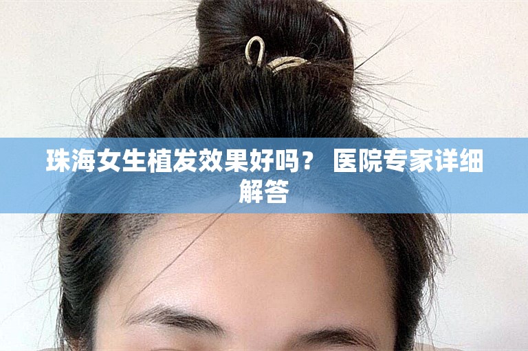 珠海女生植发效果好吗？ 医院专家详细解答