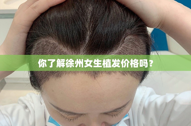 你了解徐州女生植发价格吗？