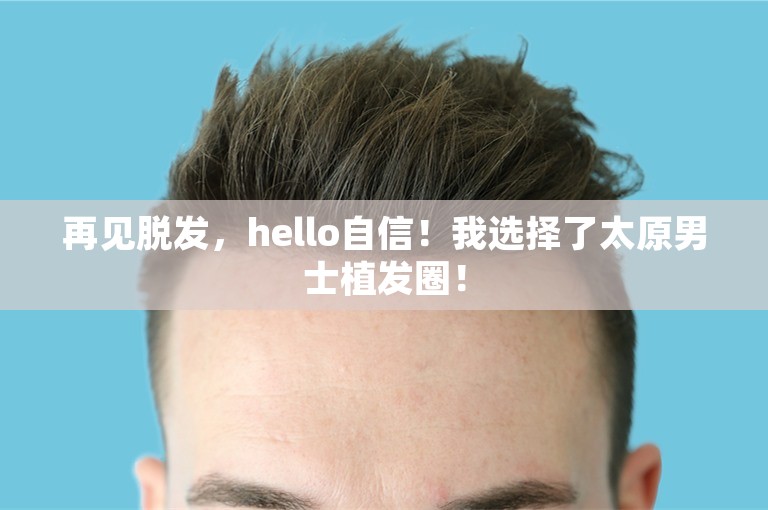 再见脱发，hello自信！我选择了太原男士植发圈！