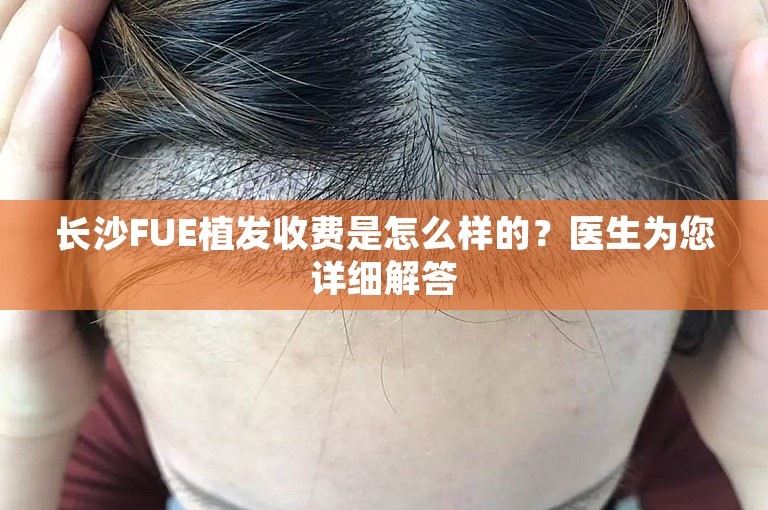 长沙FUE植发收费是怎么样的？医生为您详细解答