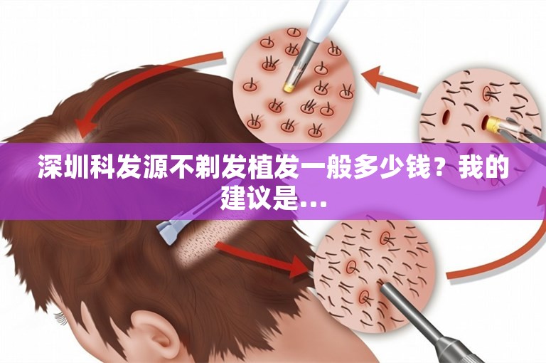 深圳科发源不剃发植发一般多少钱？我的建议是...