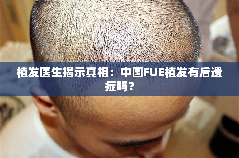 植发医生揭示真相：中国FUE植发有后遗症吗？