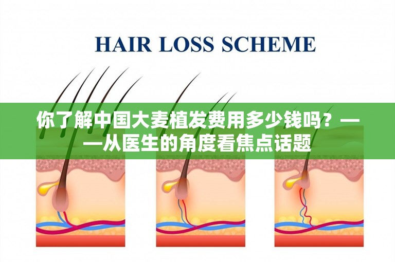你了解中国大麦植发费用多少钱吗？——从医生的角度看焦点话题