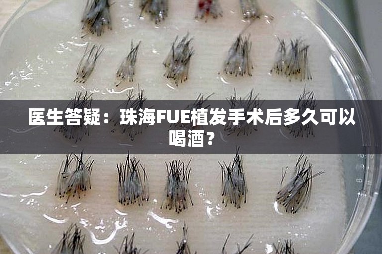 医生答疑：珠海FUE植发手术后多久可以喝酒？