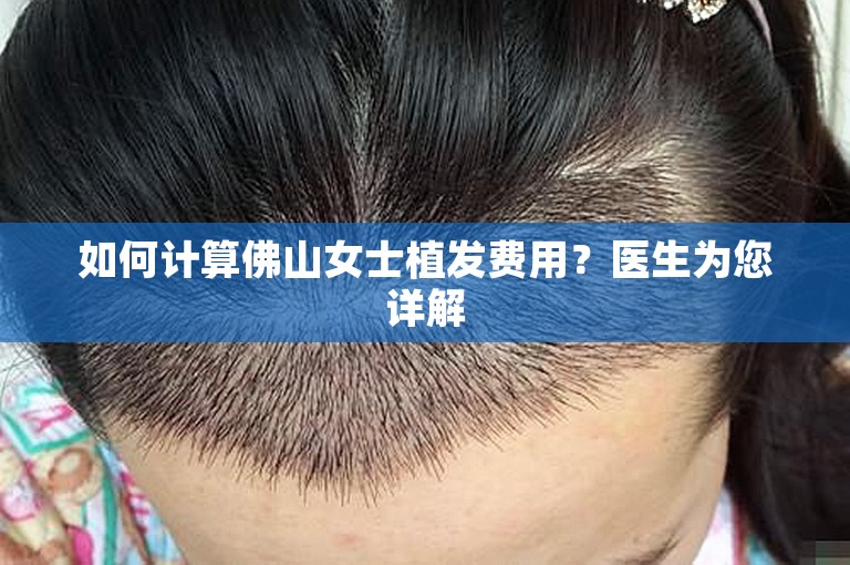 如何计算佛山女士植发费用？医生为您详解