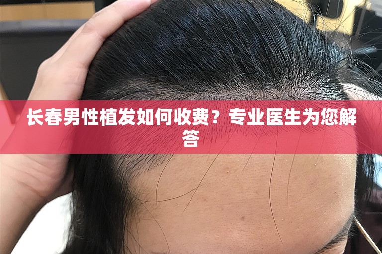 长春男性植发如何收费？专业医生为您解答