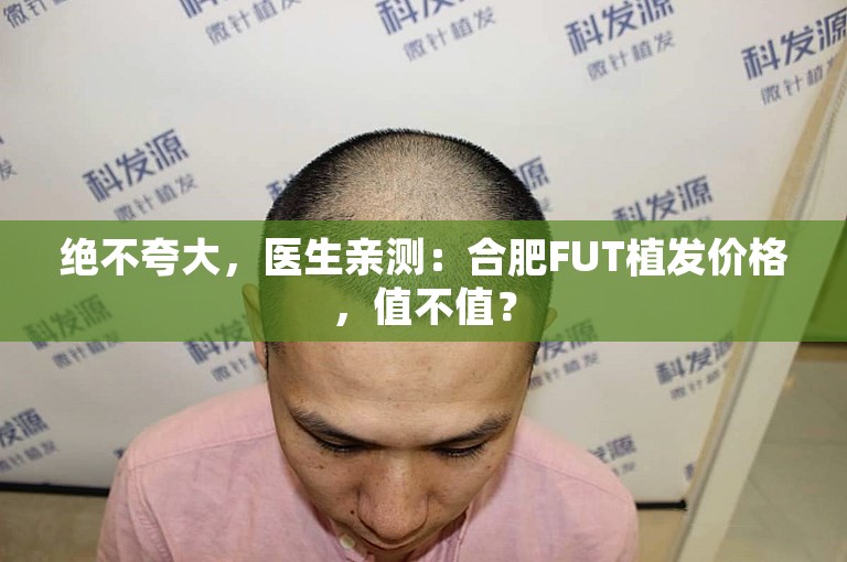 绝不夸大，医生亲测：合肥FUT植发价格，值不值？