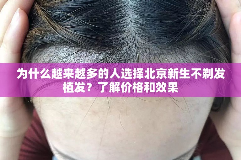 为什么越来越多的人选择北京新生不剃发植发？了解价格和效果