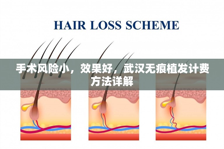 手术风险小，效果好，武汉无痕植发计费方法详解