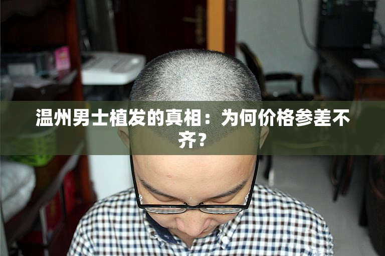 温州男士植发的真相：为何价格参差不齐？