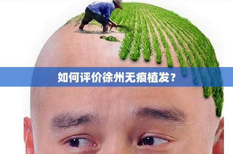 如何评价徐州无痕植发？