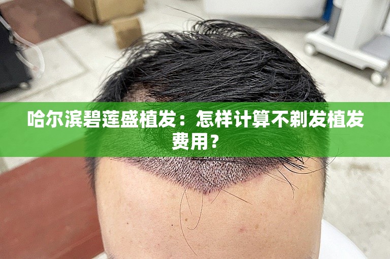 哈尔滨碧莲盛植发：怎样计算不剃发植发费用？