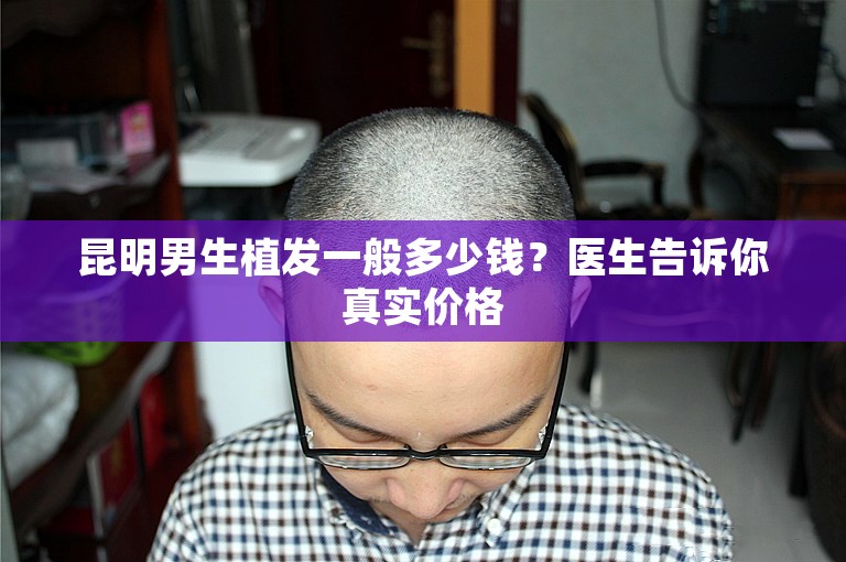 昆明男生植发一般多少钱？医生告诉你真实价格