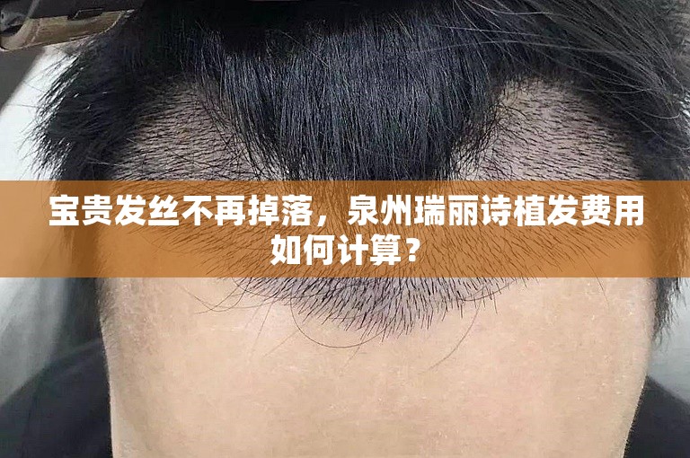 宝贵发丝不再掉落，泉州瑞丽诗植发费用如何计算？