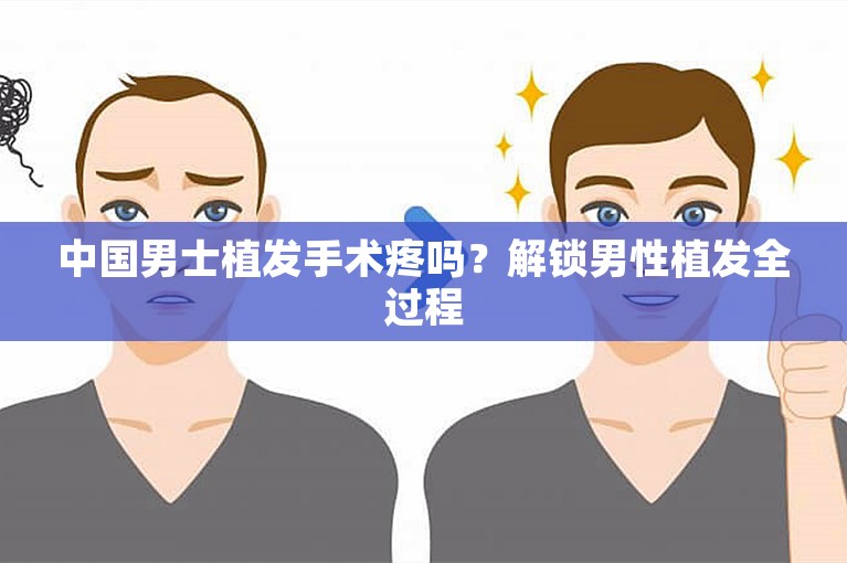 中国男士植发手术疼吗？解锁男性植发全过程