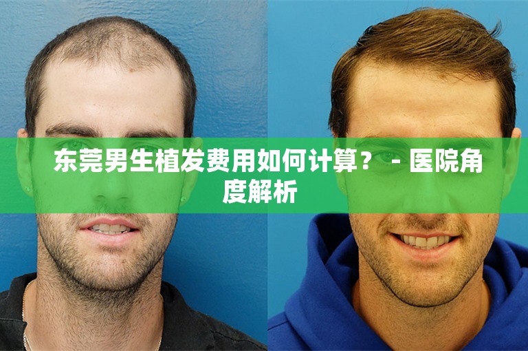  东莞男生植发费用如何计算？ - 医院角度解析 