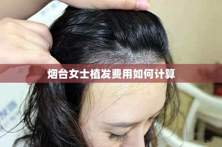 烟台女士植发费用如何计算