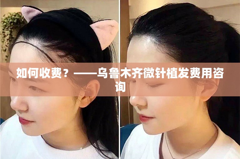 如何收费？——乌鲁木齐微针植发费用咨询