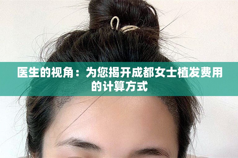 医生的视角：为您揭开成都女士植发费用的计算方式