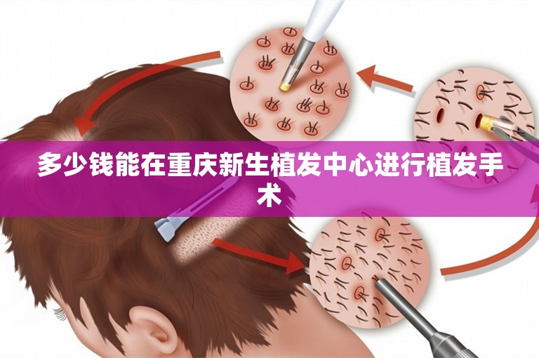 多少钱能在重庆新生植发中心进行植发手术