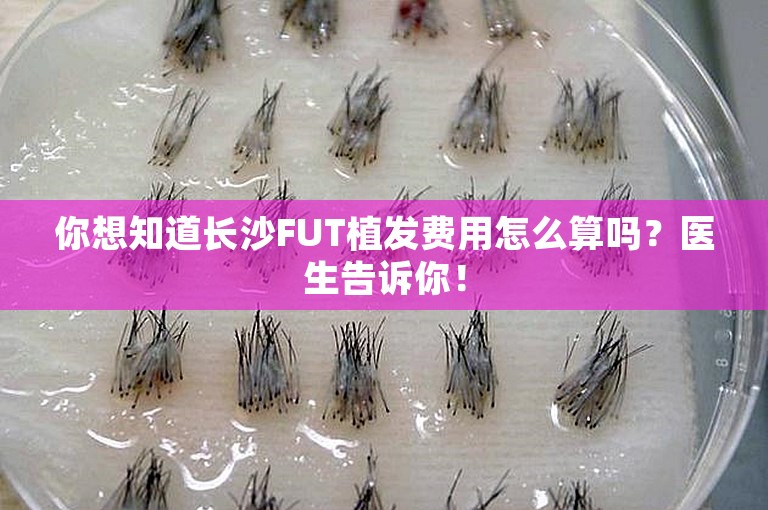 你想知道长沙FUT植发费用怎么算吗？医生告诉你！