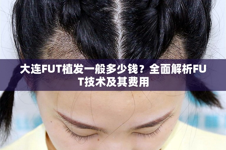 大连FUT植发一般多少钱？全面解析FUT技术及其费用