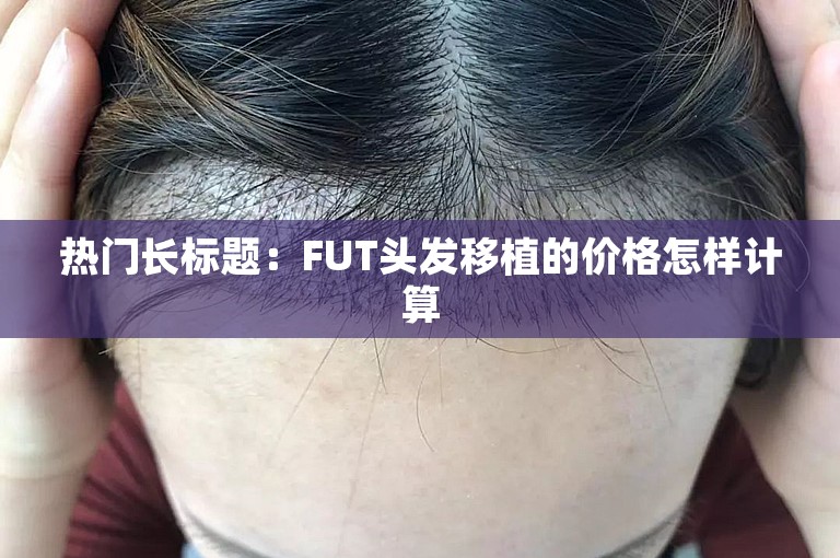 热门长标题：FUT头发移植的价格怎样计算