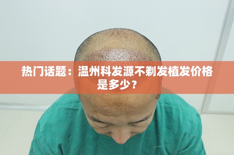 热门话题：温州科发源不剃发植发价格是多少？