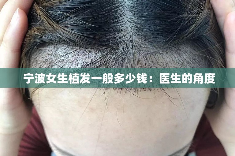  宁波女生植发一般多少钱：医生的角度