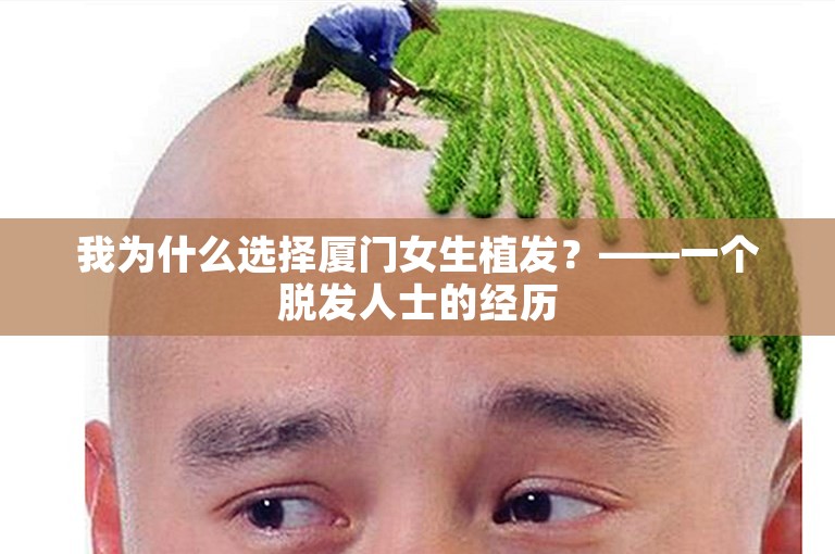 我为什么选择厦门女生植发？——一个脱发人士的经历