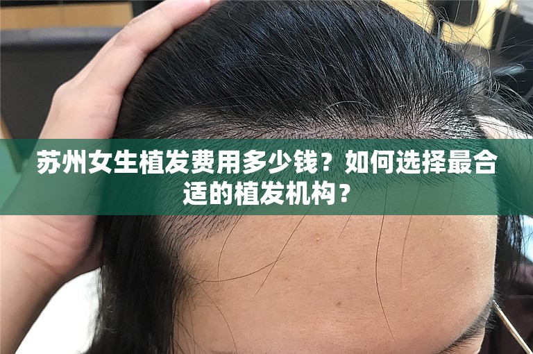 苏州女生植发费用多少钱？如何选择最合适的植发机构？