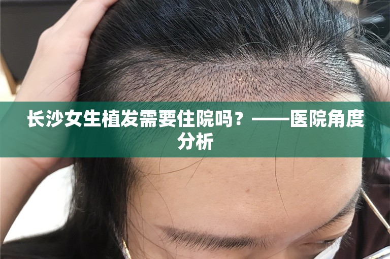 长沙女生植发需要住院吗？——医院角度分析