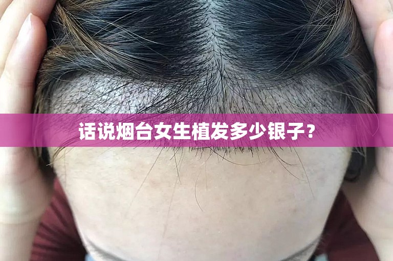 话说烟台女生植发多少银子？