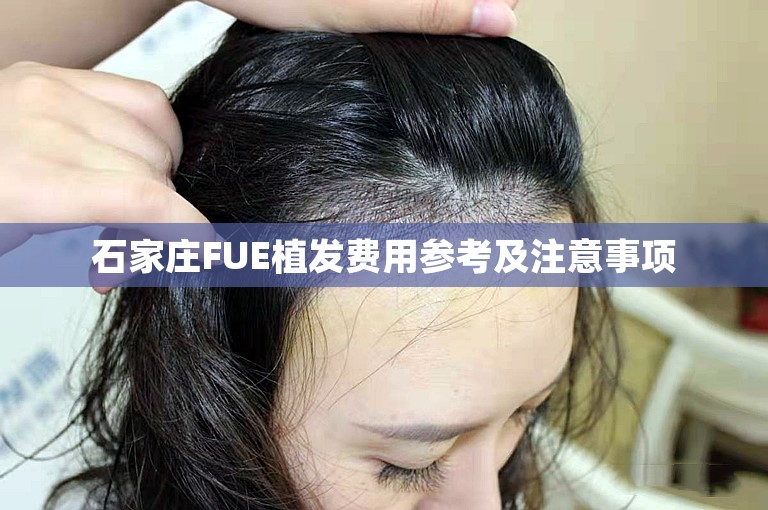 石家庄FUE植发费用参考及注意事项