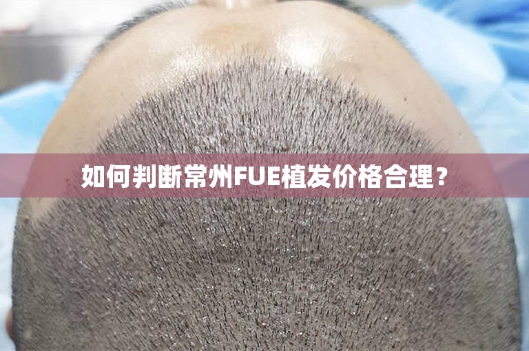 如何判断常州FUE植发价格合理？