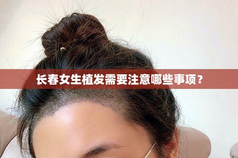 长春女生植发需要注意哪些事项？