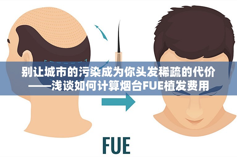 别让城市的污染成为你头发稀疏的代价——浅谈如何计算烟台FUE植发费用