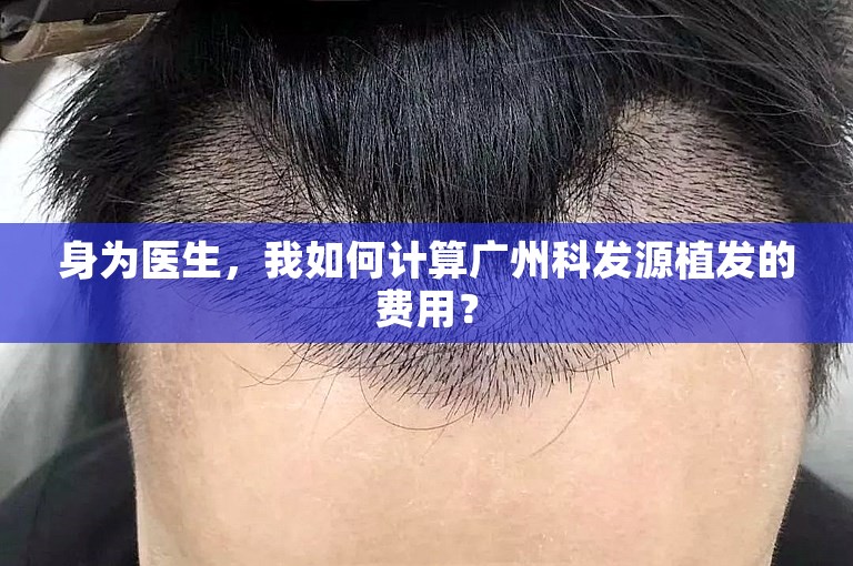 身为医生，我如何计算广州科发源植发的费用？