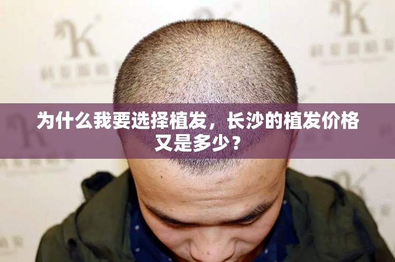 为什么我要选择植发，长沙的植发价格又是多少？